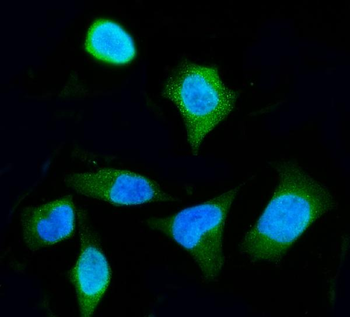 ENO3 Rabbit Polyclonal Antibody