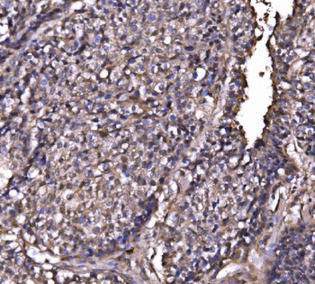 EXOSC3 Rabbit Polyclonal Antibody