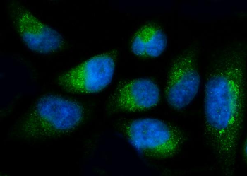Fibulin 1/FBLN1 Rabbit Polyclonal Antibody
