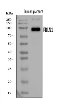 Fibulin 1/FBLN1 Rabbit Polyclonal Antibody