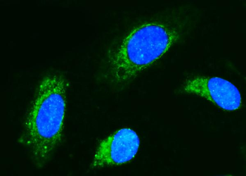 CD89/FCAR Rabbit Polyclonal Antibody