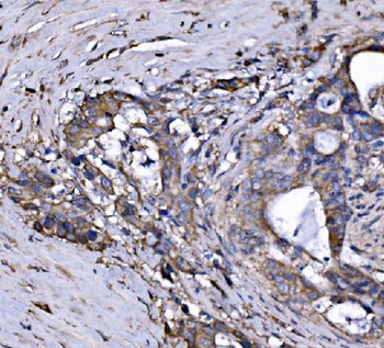 FXR1 Rabbit Polyclonal Antibody