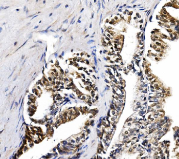 NOLA1/GAR1 Rabbit Polyclonal Antibody