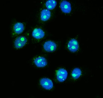 NOLA1/GAR1 Rabbit Polyclonal Antibody