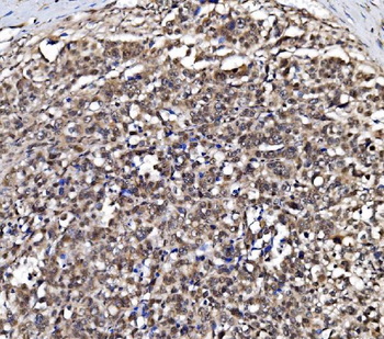 NOLA1/GAR1 Rabbit Polyclonal Antibody