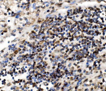 NOLA1/GAR1 Rabbit Polyclonal Antibody