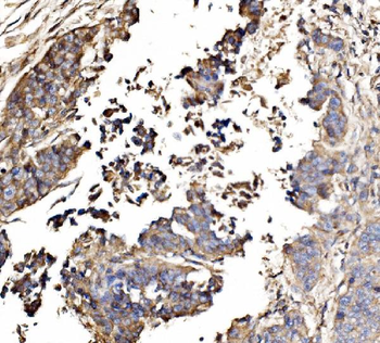 GNAL Rabbit Polyclonal Antibody