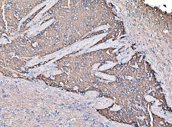 GNAL Rabbit Polyclonal Antibody