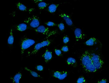 GRASP65/GORASP1 Rabbit Polyclonal Antibody