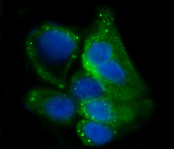 Glycogen synthase 1/GYS1 Rabbit Polyclonal Antibody