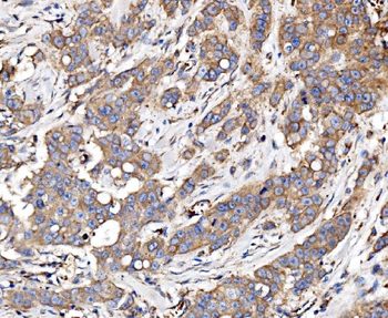 Glycogen synthase 1/GYS1 Rabbit Polyclonal Antibody