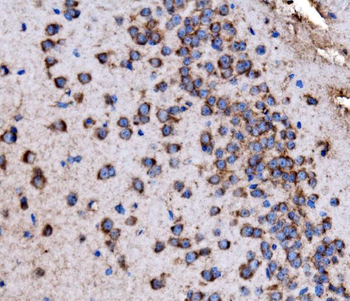 Glycogen synthase 1/GYS1 Rabbit Polyclonal Antibody