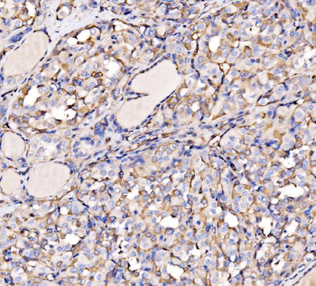 HECTD1 Rabbit Polyclonal Antibody