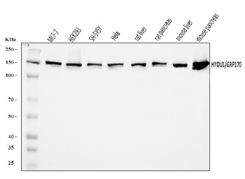 ORP150/HYOU1 Rabbit Polyclonal Antibody