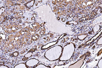 ORP150/HYOU1 Rabbit Polyclonal Antibody
