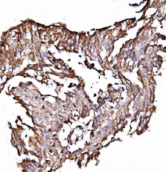 ORP150/HYOU1 Rabbit Polyclonal Antibody