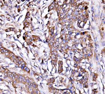 ORP150/HYOU1 Rabbit Polyclonal Antibody