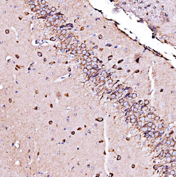 ORP150/HYOU1 Rabbit Polyclonal Antibody