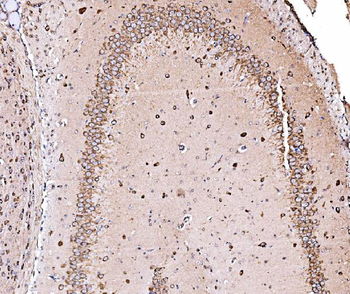 ORP150/HYOU1 Rabbit Polyclonal Antibody
