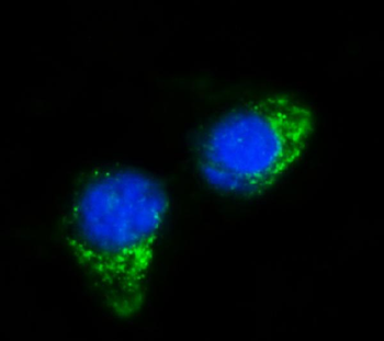 IFIT5 Rabbit Polyclonal Antibody
