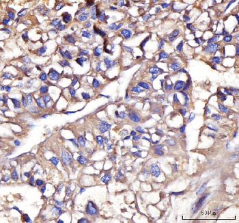 IFIT5 Rabbit Polyclonal Antibody