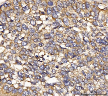 IFIT5 Rabbit Polyclonal Antibody