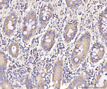 IFIT5 Rabbit Polyclonal Antibody