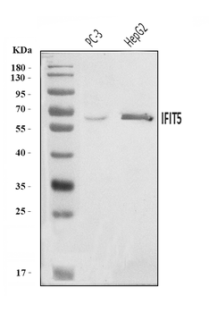 IFIT5 Rabbit Polyclonal Antibody
