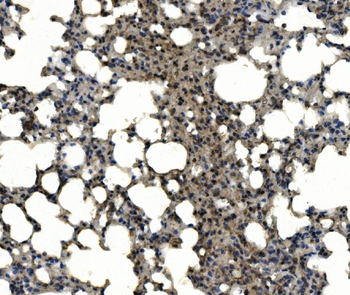 CD11c/Itgax Rabbit Polyclonal Antibody