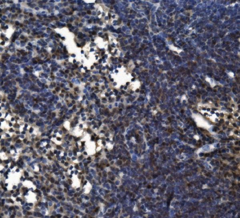 CD11c/Itgax Rabbit Polyclonal Antibody