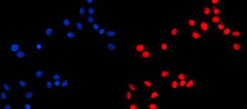 KIF4A/4B Rabbit Polyclonal Antibody