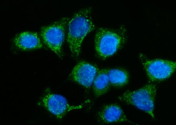 GPR54/KISS1R Rabbit Polyclonal Antibody