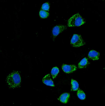 KLHL12 Rabbit Polyclonal Antibody