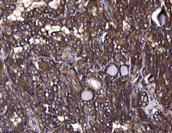 KLHL12 Rabbit Polyclonal Antibody