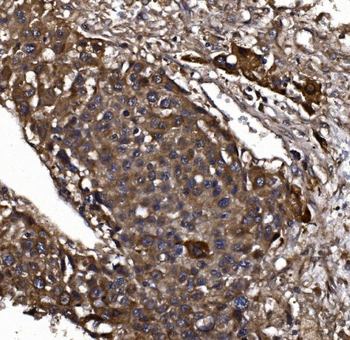 KLHL12 Rabbit Polyclonal Antibody