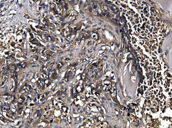 KLHL12 Rabbit Polyclonal Antibody