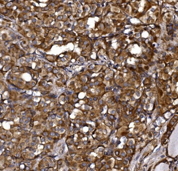 KLHL12 Rabbit Polyclonal Antibody