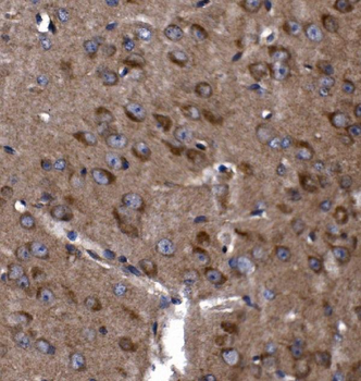 KLHL12 Rabbit Polyclonal Antibody