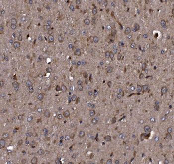 KLHL12 Rabbit Polyclonal Antibody