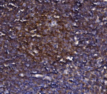KLHL12 Rabbit Polyclonal Antibody
