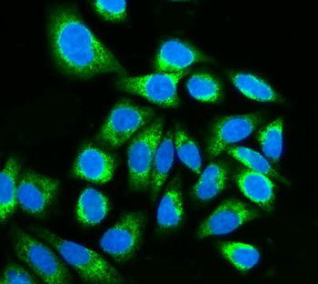 Kinectin 1/KTN1 Rabbit Polyclonal Antibody