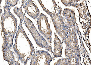 Kinectin 1/KTN1 Rabbit Polyclonal Antibody