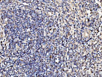 Kinectin 1/KTN1 Rabbit Polyclonal Antibody