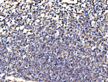 Kinectin 1/KTN1 Rabbit Polyclonal Antibody
