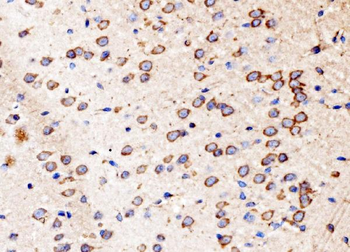 Kinectin 1/KTN1 Rabbit Polyclonal Antibody