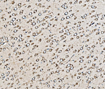 Kinectin 1/KTN1 Rabbit Polyclonal Antibody