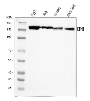 Kinectin 1/KTN1 Rabbit Polyclonal Antibody