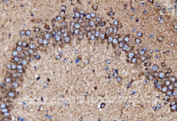MDH2 Rabbit Polyclonal Antibody