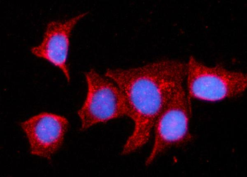 MDH2 Rabbit Polyclonal Antibody