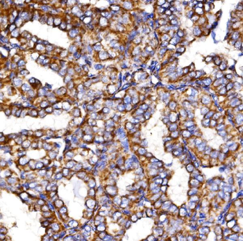 MDH2 Rabbit Polyclonal Antibody